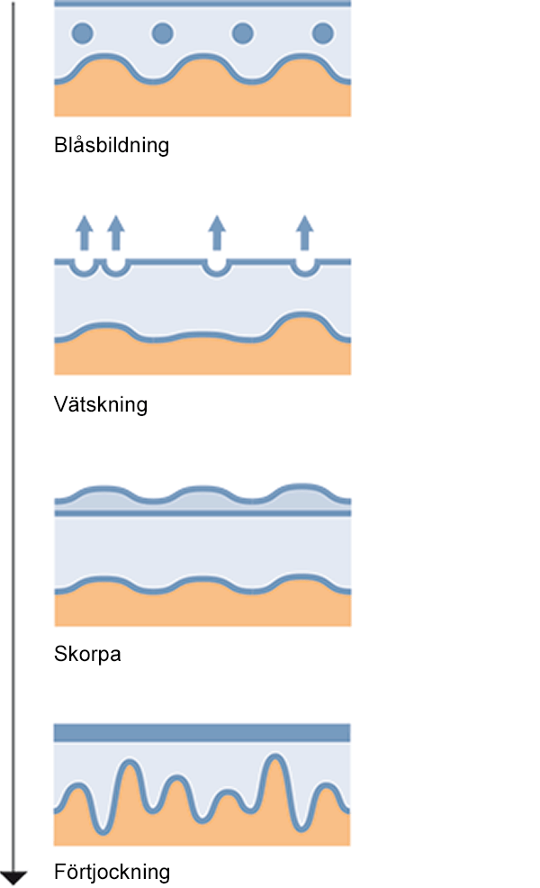 Eksemförlopp